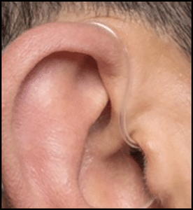 Harry's Hearing Aid Eavesdropping Device